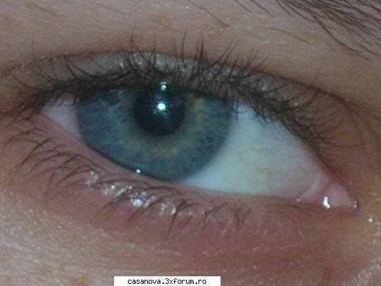 Ce parere aveti despre noul virus ? - care virus?????ala care iti distruge definitiv - .::Discutii Libere::.